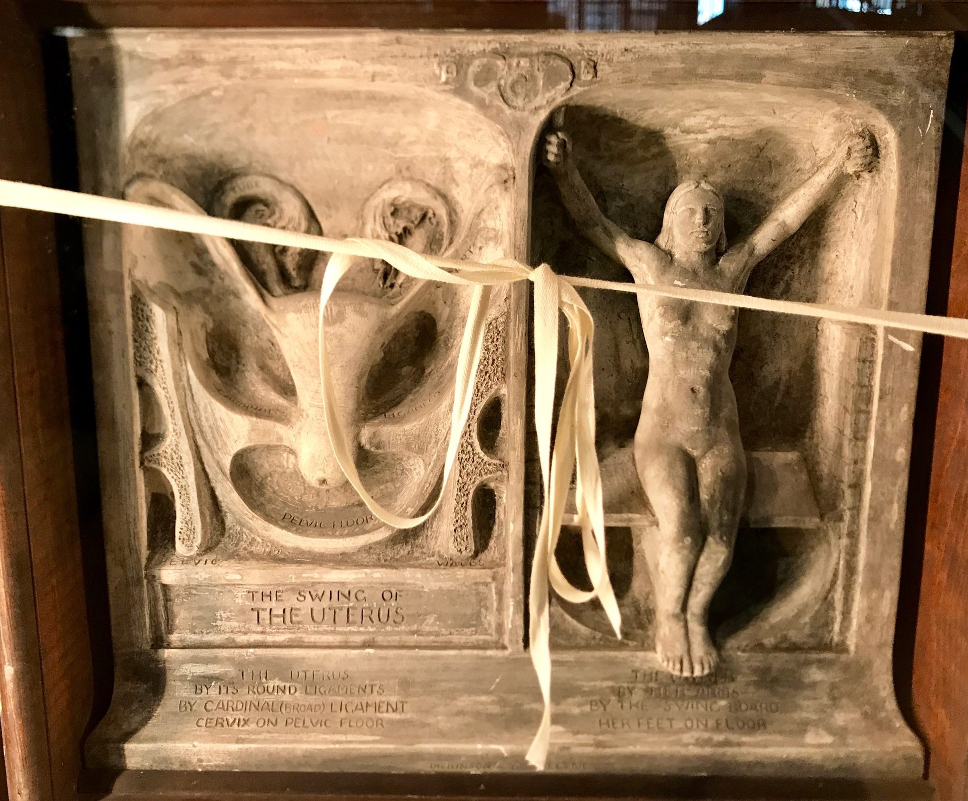 Dickinson-Belskie Collection, Warren Anatomical Museum, Boston (by Luca Ambrosio) (5).jpg